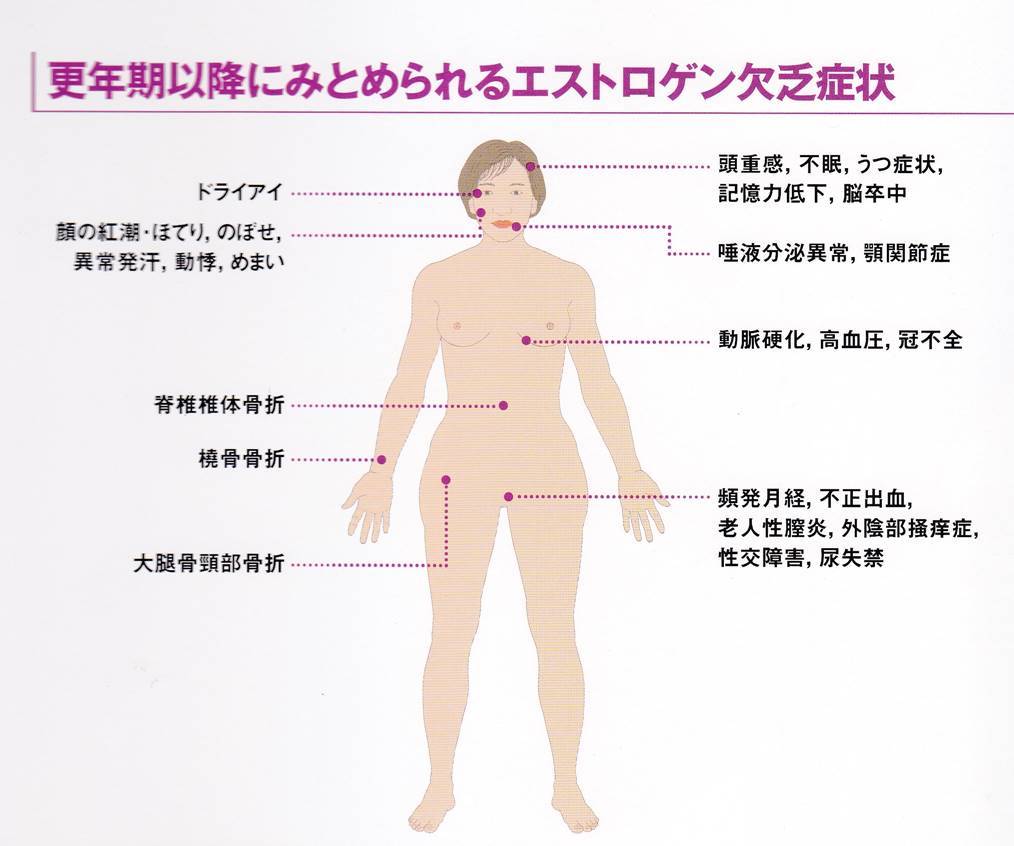 更年期以降にみとめられるエストロゲン欠乏症