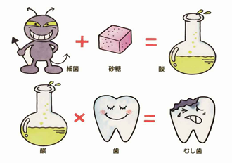 虫歯の原因